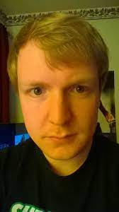 Check spelling or type a new query. Receding Hairline Is It A Big Deal Off Topic Giant Bomb