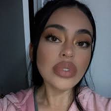 Lipo 360 with J plasma results and comparison to tummy tuck