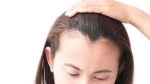 How To Regrow A Thinning Hairline Fast Thinning Hairline Hairstyles For Receding Hairline Regrow Hairline