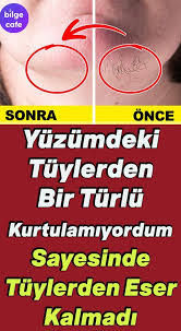 Evinizdeki Malzemelerle Yuz Tuylerinizden Kurtulun 2020 Endokrin Sistem Dogal Cilt Bakimi Saglik Bakim
