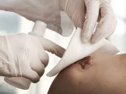 Consult a doctor for medical advice. Cdc Progress Stalled Against Staph Mrsa Infections Cidrap