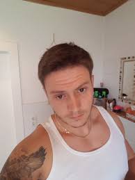 Haartransplantation Forum : Bicer » Bart Haartransplantation, GE und  Haarlinie