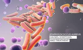 Disseminated intravascular coagulation (dic) is a rare but serious condition that causes abnormal blood clotting throughout the body's blood vessels. Staphylococcus Aureus Causes Symptoms And Treatment