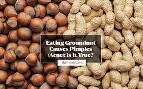 Peanut Groundnut Causes Pimples Acne Myth Or Fact Thrivenaija