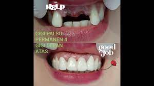 Check spelling or type a new query. Cewek Cantik Ompong Jadi Jelek Setelah Pasang Gigi Palsu Jadi Cantik Kembali Mirip Kintan Mary Youtube