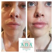 Aba_aestheticsbyadria