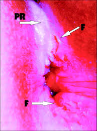 I don't know all the answers to your questions, but i wanted to share this with you. Sexual Abuse In Children American Academy Of Pediatrics