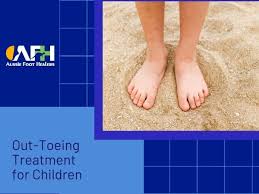 Image result for Out-toeing