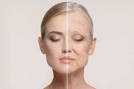 The top 10 causes of skin aging | Van Rosmalen Kliniek