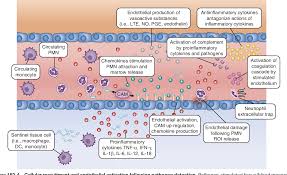 Image result for Neonatal Sepsis