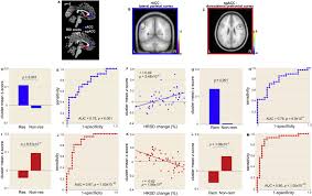 It consists of brodmann areas 24, 32, and 33. Functional Connectivity Of The Anterior Cingulate Cortex Predicts Treatment Outcome For Rtms In Treatment Resistant Depression At 3 Month Follow Up Brain Stimulation Basic Translational And Clinical Research In Neuromodulation