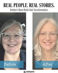 Kristen started her weightloss journey, and from day one, the results spoke  for themselves—7.5 pounds down in two weeks, then 10 pounds a month  consistently! Her secret? Her #weightloss journey = 21 ...