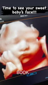 My Baby Debut 3D 4D Ultrasound