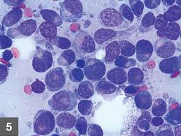 They include rarely, lymphoma affects lymph nodes located in the lower back. Feline Lymphoma Clinician S Brief