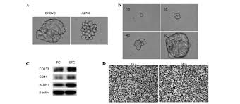Ovarian cancer is linked with hereditary and environmental factors. 7 Difluoromethoxyl 5 4 Di N Octyl Genistein Inhibits Ovarian Cancer Stem Cell Characteristics Through The Downregulation Of Foxm1