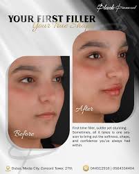 Weekend vibes, endless smiles Dr. Sina Ali keeps the joy flowing! ready for  more magic next week! Book your free consultation with Our Smile Makeover  Expert @dr.sina_ali @blackdiamonddc @dr.sina_ali For Bookings please