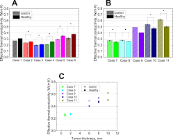 There are multiple types of skin lesions. First In Human Clinical Study Of Novel Technique To Diagnose Malignant Melanoma Via Thermal Conductivity Measurements Scientific Reports