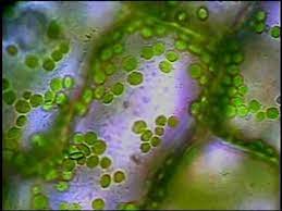 A cell is a very tiny structure which exists in living bodies. Plant Cells And Chloroplasts Youtube