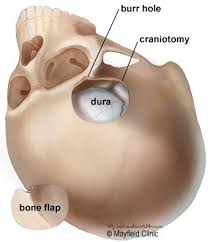 Pin On Acupuncture