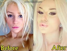 Courtney stodden's breast implants before after. Courtney Stodden Plastic Surgery Before And After Plastic Surgery Hits