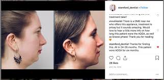 Kumpulan 111 90 l 150 204 videos spektekno saking populer nya menjadikan yang paling banyak di google pencarian. Dental Care Of Stamford Dr Simon Edukasi News
