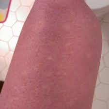 Pin On Such A Silly Sick Chick