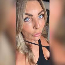 My before and nearly 2 months after. So happy. I would recommend to anyone  to have done, but just do your research ☺️ The Skin Surgery Clinic, Leeds UK