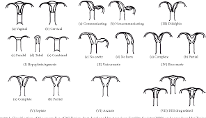 We did not find results for: Figure 1 From Mayer Rokitansky Kuster Hauser Syndrome Embryology Genetics And Clinical And Surgical Treatment Semantic Scholar