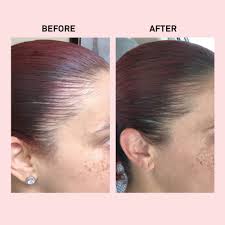 Sales of vegamour's gro hair serum have increased by 500 percent since the start of the coronavirus pandemic in march. Amazon Com Vegamour Gro Density Boosting Hair Serum Foam Natural Dht Inhibitor Plant Based Vegan Cruelty Free Volumizing Formula Strengthens And Thickens For Healthy Growth 2oz Beauty