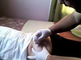 Intramuscular Youtube