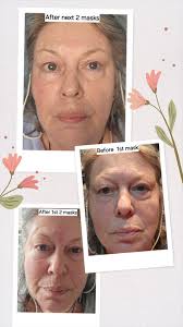 Bio-Collagen Eye Patches