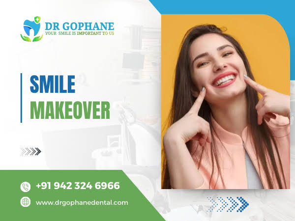Smile Makeover In Yavatmal product image