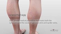 Vein Clinics Of America Youtube