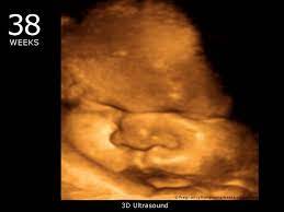 Pin On Pregnancy And Fetal Development