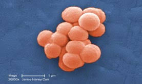 Image result for Group D Streptococcus