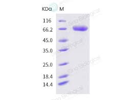 Maybe you would like to learn more about one of these? Recombinant Sars Cov 2 Coronavirus Spike Protein Baculovirus Insect Cells His Tag 40590 V08b Sino Biological