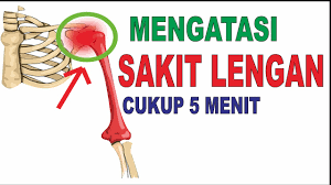 Es batu yang dibungkus handuk, sekantong kacang polong beku, atau bahkan mandi air dingin dapat. Cara Mengatasi Sakit Lengan Atas Youtube