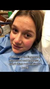 Understanding Charcoal Lips in Mental Health: A Message of Hope