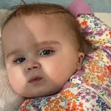 Fundraiser for Skylar Morrissey by Jessica Lombardo : Rally for Noelle:  Medical Care and Support