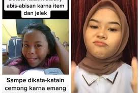 Sempat Dibully Gegara Punya Wajah Dekil Dan Berkulit Hitam Kini Wajah Wanita Ini Berubah Glowing Dan Cantik Bak Selebgram Begini Kisahnya Yang Jadi Viral Semua Halaman Suar