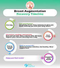 Even several weeks after a breast lift, you may still tire a little more easily, and you will still be restricted in how much you can lift. A Complete Guide To Breast Augmentation Recovery Ariamedtour