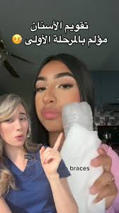 ⚠️ ارتداء التقويم يمكن أن يسبب بعض الألم والانزعاج،. هي خمس طرق لتقليل  الألم ✋🏻:1. تناول مسكنات الألم بدون وصفة طبية (مثل الإيبوبروفين أو  الباراسيتامول) 💊😷2. الأطعمة اللينة مثل الزبادي، البطاطس، ...