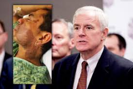 Milwaukee mayor blames Trump after Latino man burned with acid, told "go  back to your country"