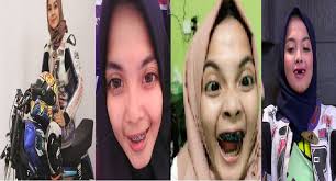 See full list on cekaja.com Gara Gara Behel Kawat Gigi Pembalap Cantik Ini Jadi Ompong Kok Bisa Ini Kisahnya