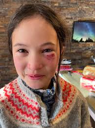 Mont Tremblant mogul jump photo request