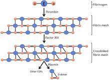 If 1:2 dilution is positive, fdp level is from 5 to 20 ug/ml and if 1:8 dilution is positive, the level of fdp is more than 20 ug/ml. Fibrin Degradation Product Wikipedia