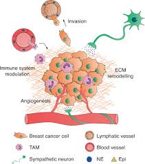 Although breast cancer is so common, you're likely really scared if you've noticed changes in your get comfortable with your breasts. Sympathetic Activity In Breast Cancer And Metastasis Partners In Crime Bone Research