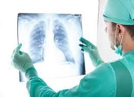 Lungenschmerzen Symtom Anzeichen Ursachen Diagnose Behandlung Krank De