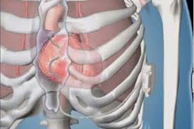 Each code begins with a letter, and that letter is followed by two numbers. Pilot Study Of Investigational Extravascular Icd System Begins