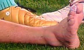 Messi se toca el tobillo izquierdo después del duro golpe que recibió de fabra. Asi Quedo El Tobillo De Messi Tras Su Lesion